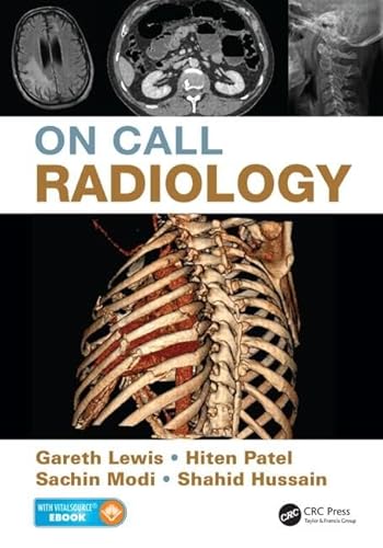 On Call Radiology von CRC Press